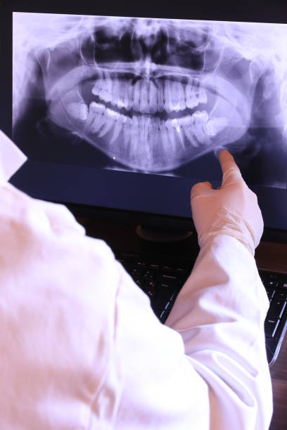 Best Emergency Root Canal Treatment in Wyoming, IL