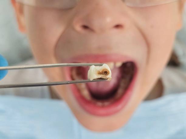 Best Holiday Emergency Dentist in Wyoming, IL